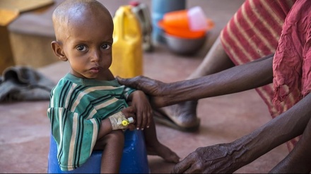 Unicef: Mehr als ein Drittel der Kinder im Sudan leidet unter Unterernährung
